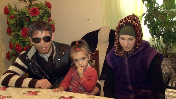 Azərbaycanlı gənc gözlərini sevgisinə qurban verdi: Yuxuda görə bilirəm 